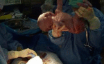 Videos of Surgery Videos of Surgery